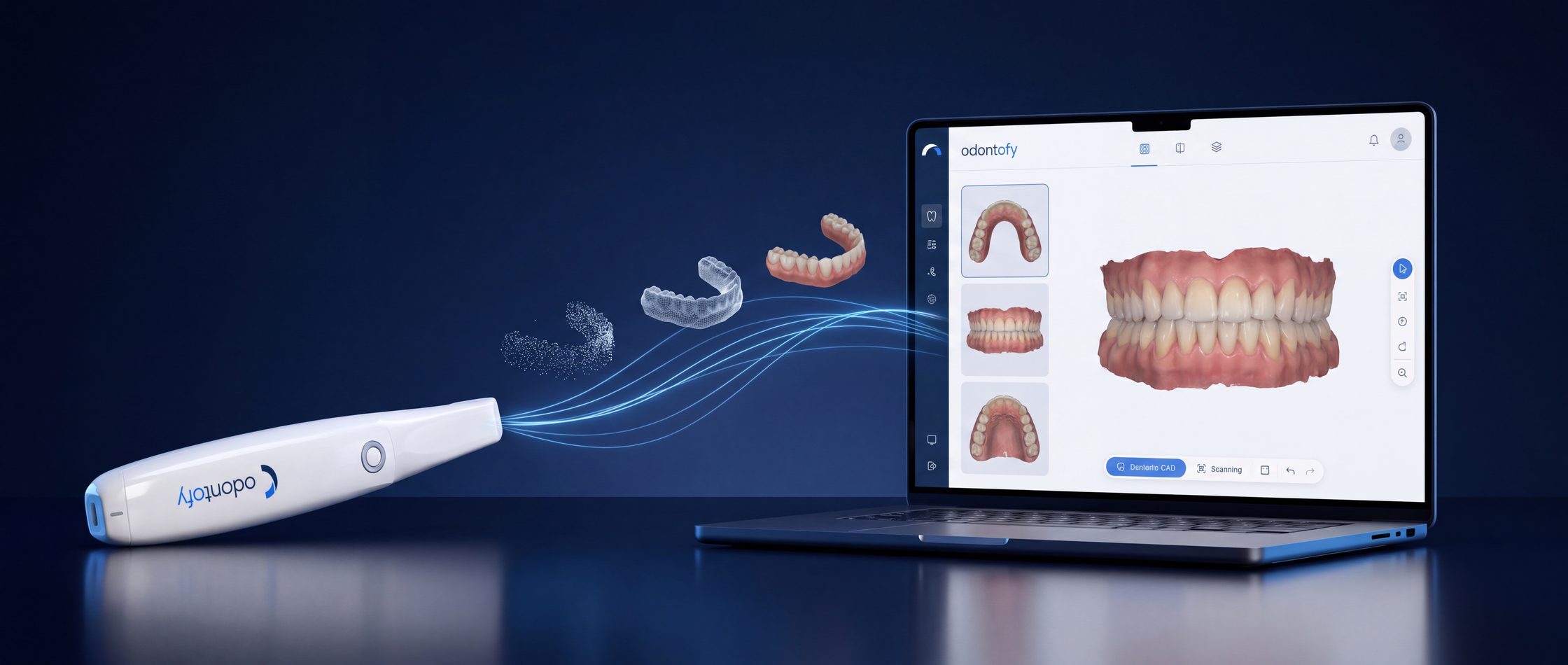 Odontofy Scan collegato al software: dal manipolo al modello 3D sul laptop